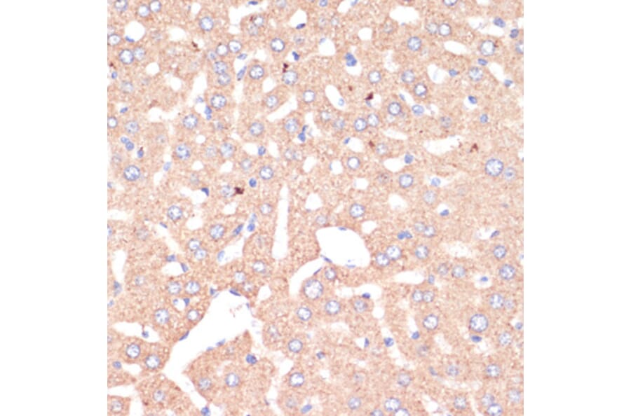 Immunohistochemistry - Anti-ATP5A Antibody (A15034) - Antibodies.com
