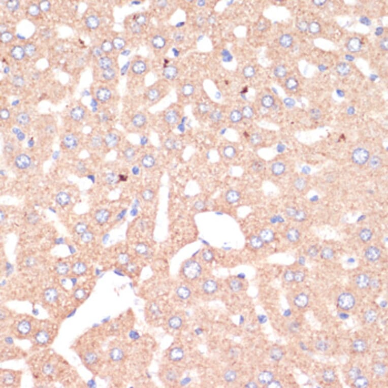 Immunohistochemistry - Anti-ATP5A Antibody (A15034) - Antibodies.com