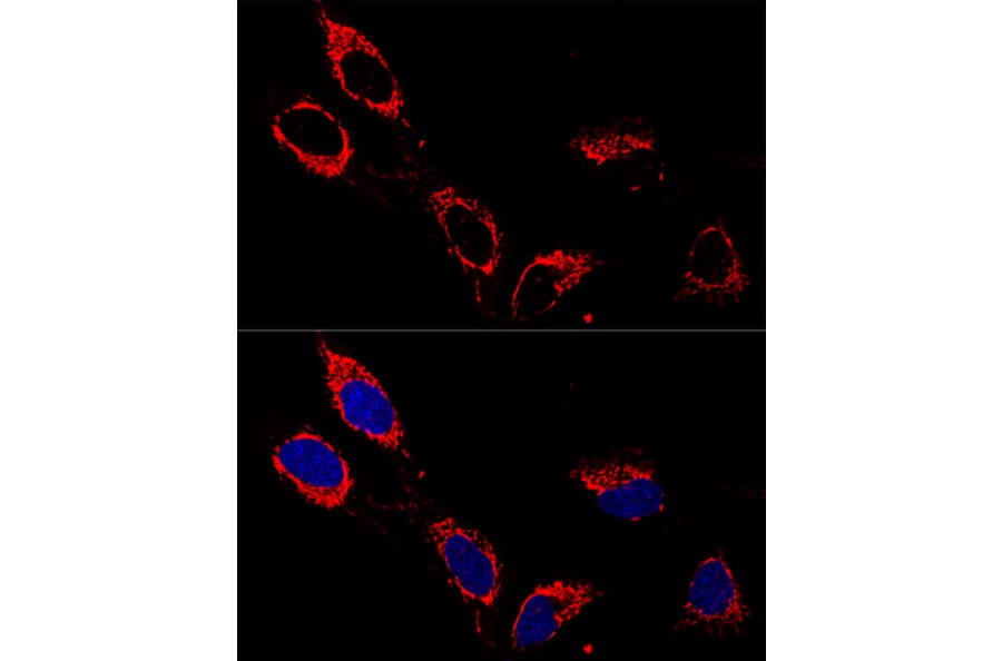Immunofluorescence - Anti-ATP5A Antibody (A15034) - Antibodies.com