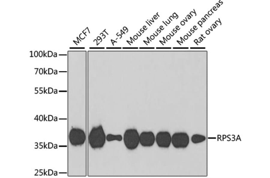 Western Blot - Anti-RPS3A Antibody (A15035) - Antibodies.com