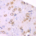 Immunohistochemistry - Anti-RPS3A Antibody (A15035) - Antibodies.com