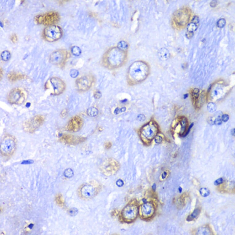 Immunohistochemistry - Anti-RPS3A Antibody (A15035) - Antibodies.com