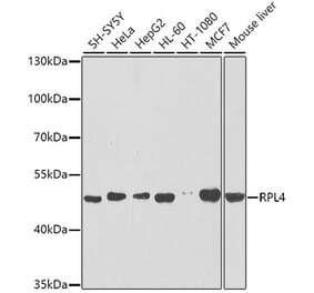 Western Blot - Anti-RPL4 Antibody (A15036) - Antibodies.com