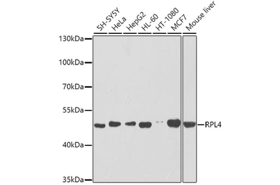 Western Blot - Anti-RPL4 Antibody (A15036) - Antibodies.com