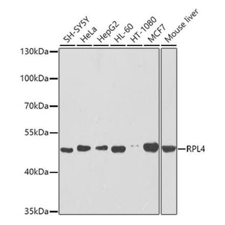 Western Blot - Anti-RPL4 Antibody (A15036) - Antibodies.com