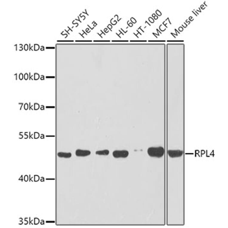 Western Blot - Anti-RPL4 Antibody (A15036) - Antibodies.com