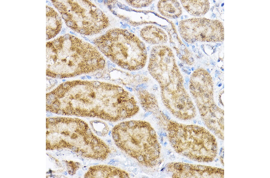 Immunohistochemistry - Anti-RPL4 Antibody (A15036) - Antibodies.com
