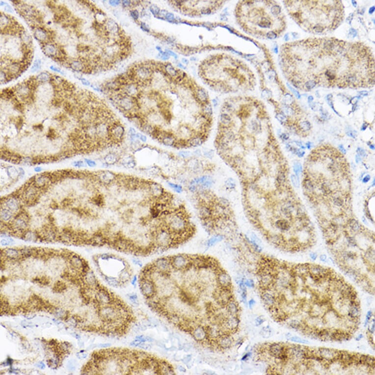 Immunohistochemistry - Anti-RPL4 Antibody (A15036) - Antibodies.com