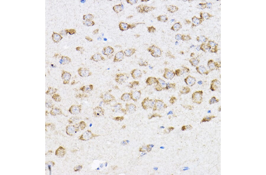 Immunohistochemistry - Anti-RPL4 Antibody (A15036) - Antibodies.com