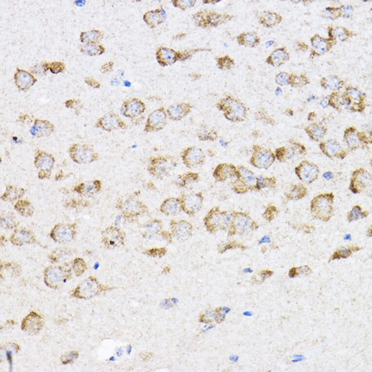 Immunohistochemistry - Anti-RPL4 Antibody (A15036) - Antibodies.com