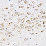 Immunohistochemistry - Anti-RPL4 Antibody (A15036) - Antibodies.com