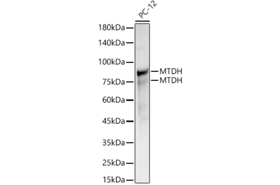 Western Blot - Anti-LYRIC/AEG1 Antibody (A15037) - Antibodies.com