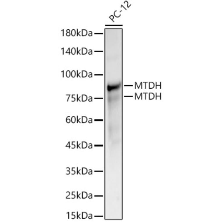 Western Blot - Anti-LYRIC/AEG1 Antibody (A15037) - Antibodies.com