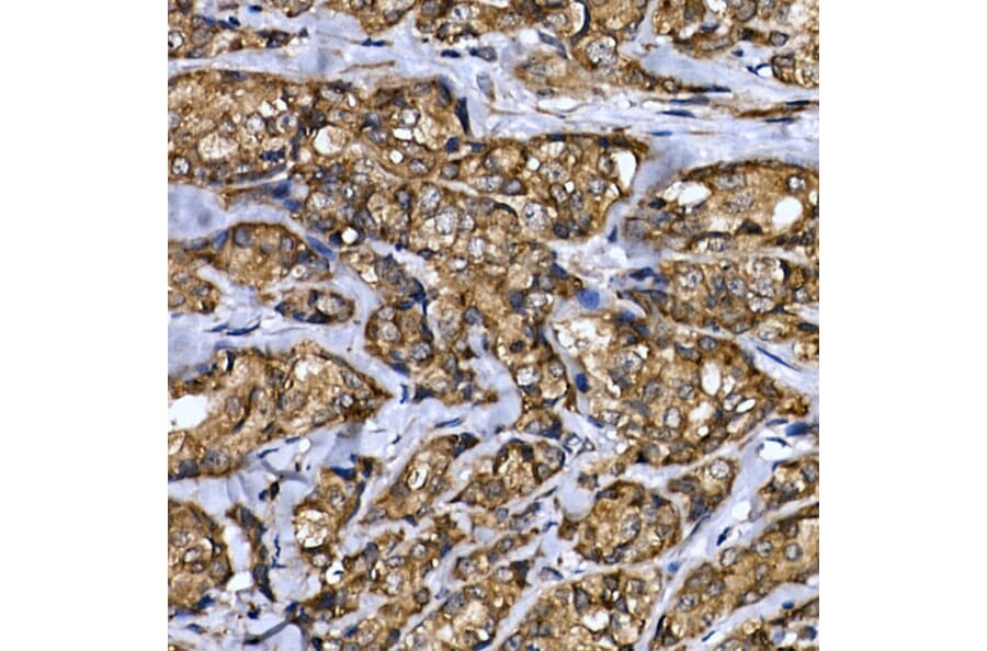 Immunohistochemistry - Anti-LYRIC/AEG1 Antibody (A15037) - Antibodies.com