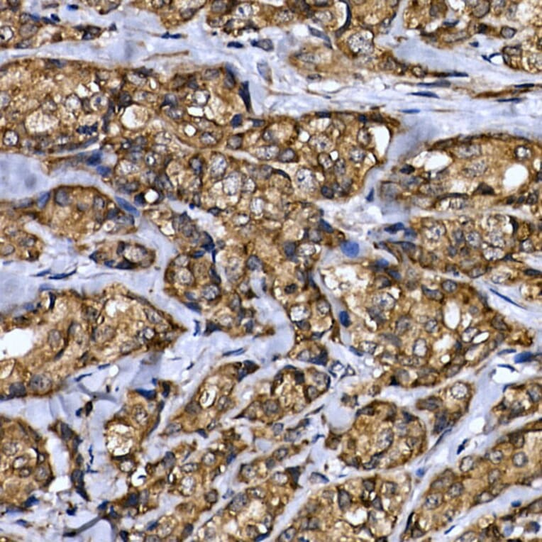 Immunohistochemistry - Anti-LYRIC/AEG1 Antibody (A15037) - Antibodies.com