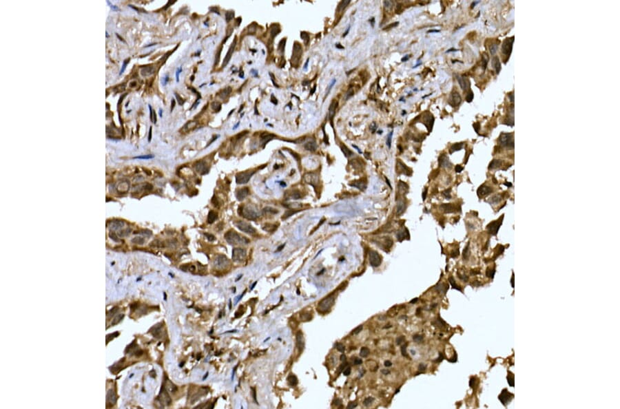 Immunohistochemistry - Anti-LYRIC/AEG1 Antibody (A15037) - Antibodies.com