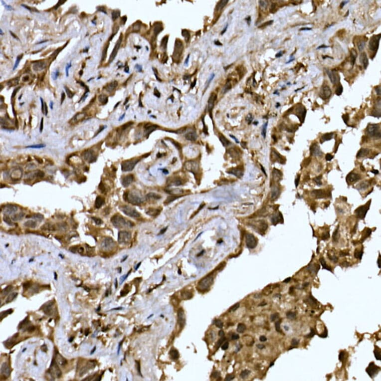 Immunohistochemistry - Anti-LYRIC/AEG1 Antibody (A15037) - Antibodies.com