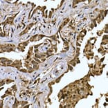 Immunohistochemistry - Anti-LYRIC/AEG1 Antibody (A15037) - Antibodies.com