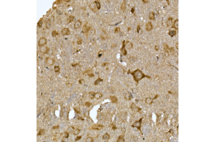 Immunohistochemistry - Anti-LYRIC/AEG1 Antibody (A15037) - Antibodies.com