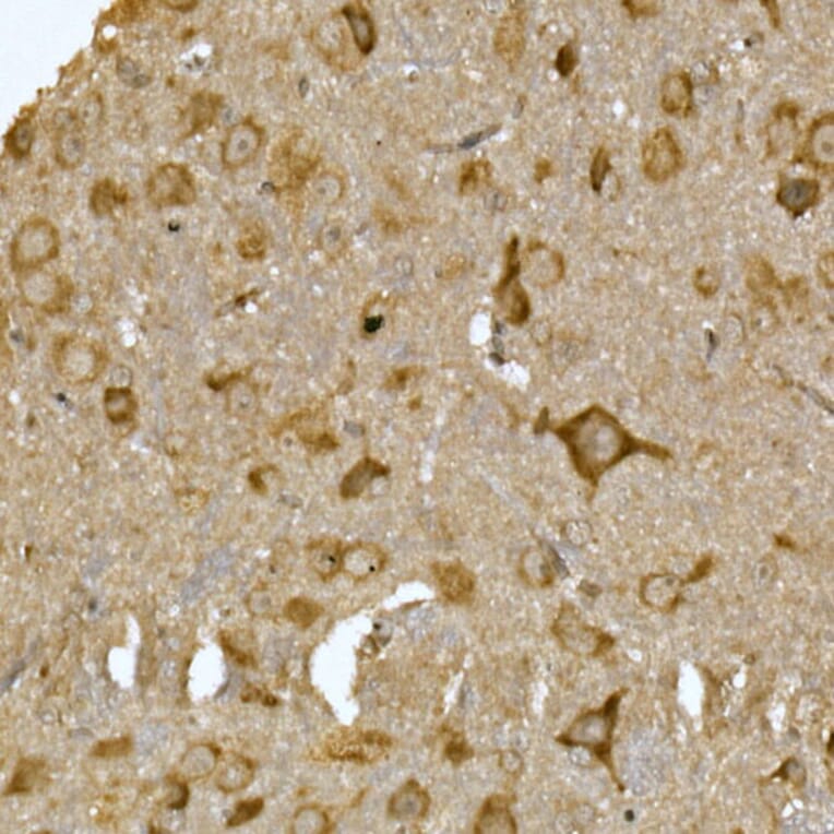 Immunohistochemistry - Anti-LYRIC/AEG1 Antibody (A15037) - Antibodies.com