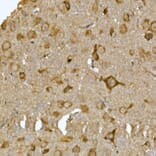 Immunohistochemistry - Anti-LYRIC/AEG1 Antibody (A15037) - Antibodies.com