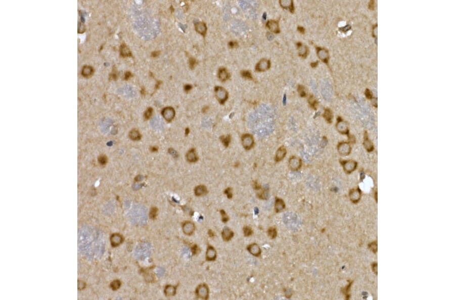 Immunohistochemistry - Anti-LYRIC/AEG1 Antibody (A15037) - Antibodies.com