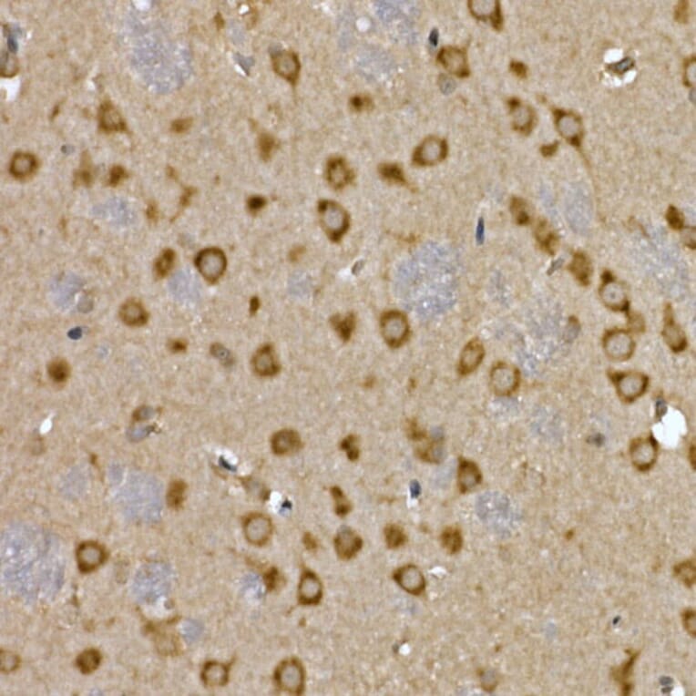 Immunohistochemistry - Anti-LYRIC/AEG1 Antibody (A15037) - Antibodies.com