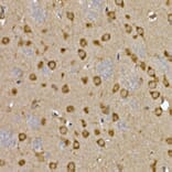 Immunohistochemistry - Anti-LYRIC/AEG1 Antibody (A15037) - Antibodies.com