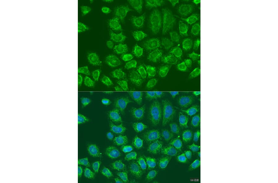 Immunofluorescence - Anti-LYRIC/AEG1 Antibody (A15037) - Antibodies.com