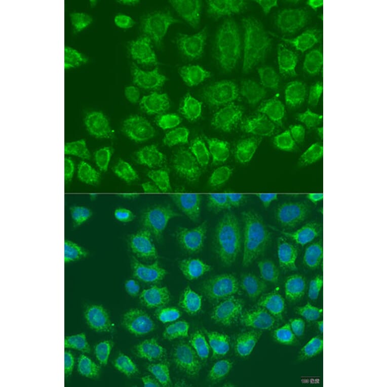 Immunofluorescence - Anti-LYRIC/AEG1 Antibody (A15037) - Antibodies.com