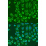 Immunofluorescence - Anti-LYRIC/AEG1 Antibody (A15037) - Antibodies.com