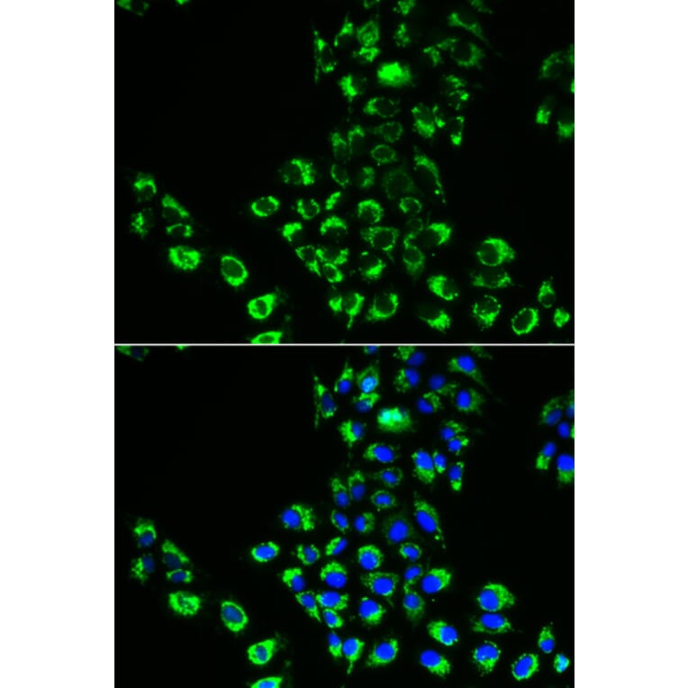 Immunofluorescence - Anti-EIF5B Antibody (A5888) - Antibodies.com