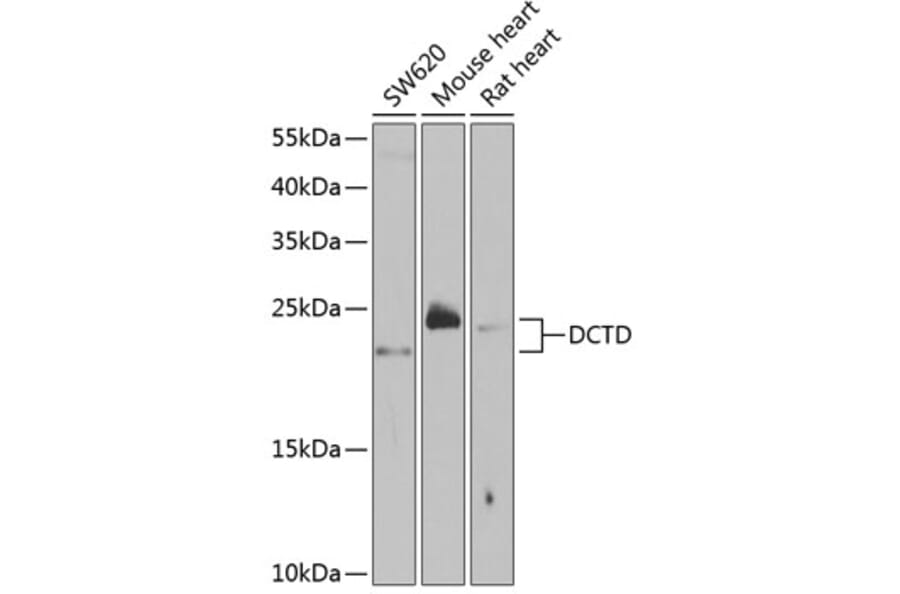 Western Blot - Anti-DCTD Antibody (A5889) - Antibodies.com