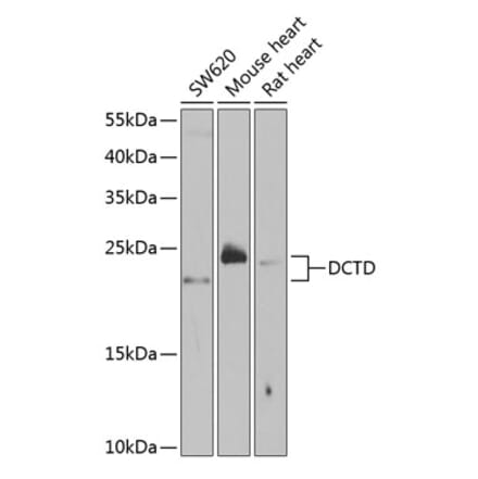 Western Blot - Anti-DCTD Antibody (A5889) - Antibodies.com