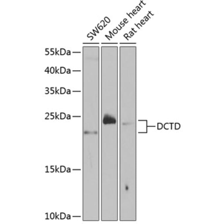 Western Blot - Anti-DCTD Antibody (A5889) - Antibodies.com