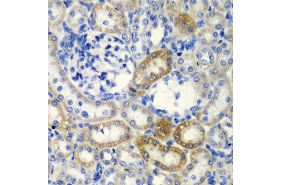 Immunohistochemistry - Anti-DCTD Antibody (A5889) - Antibodies.com