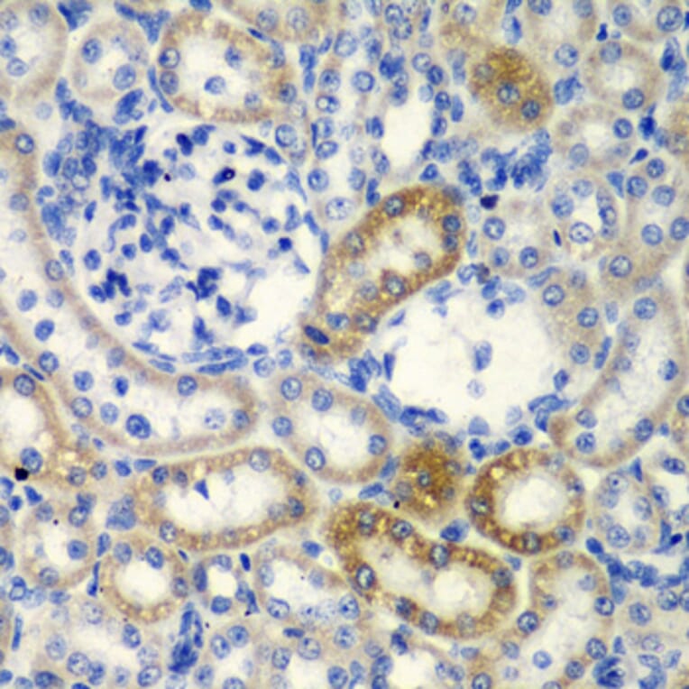 Immunohistochemistry - Anti-DCTD Antibody (A5889) - Antibodies.com