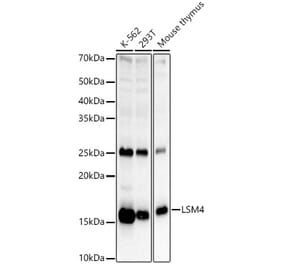 Western Blot - Anti-LSM4 Antibody (A15040) - Antibodies.com