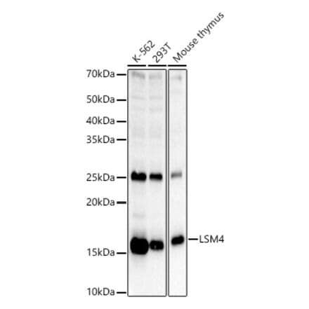 Western Blot - Anti-LSM4 Antibody (A15040) - Antibodies.com