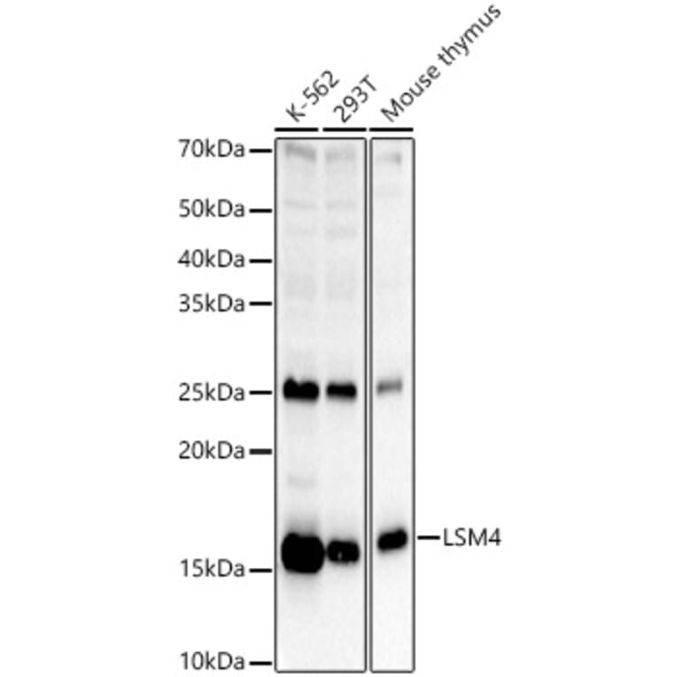 Western Blot - Anti-LSM4 Antibody (A15040) - Antibodies.com