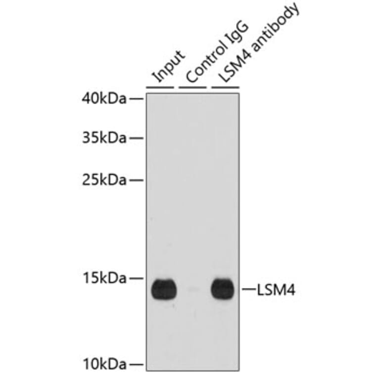 Western Blot - Anti-LSM4 Antibody (A15040) - Antibodies.com