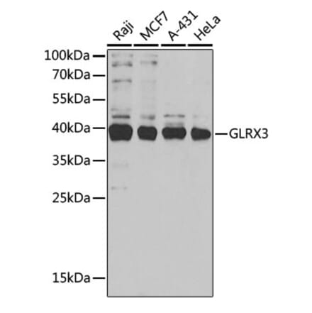 Western Blot - Anti-PICOT Antibody (A15041) - Antibodies.com