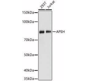 Western Blot - Anti-APH Antibody (A15042) - Antibodies.com