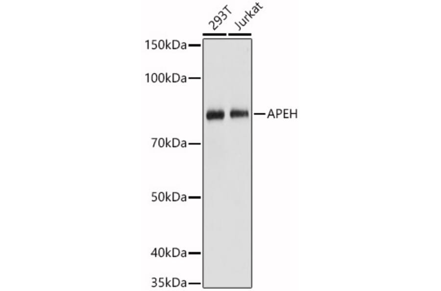 Western Blot - Anti-APH Antibody (A15042) - Antibodies.com