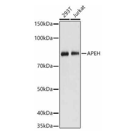 Western Blot - Anti-APH Antibody (A15042) - Antibodies.com