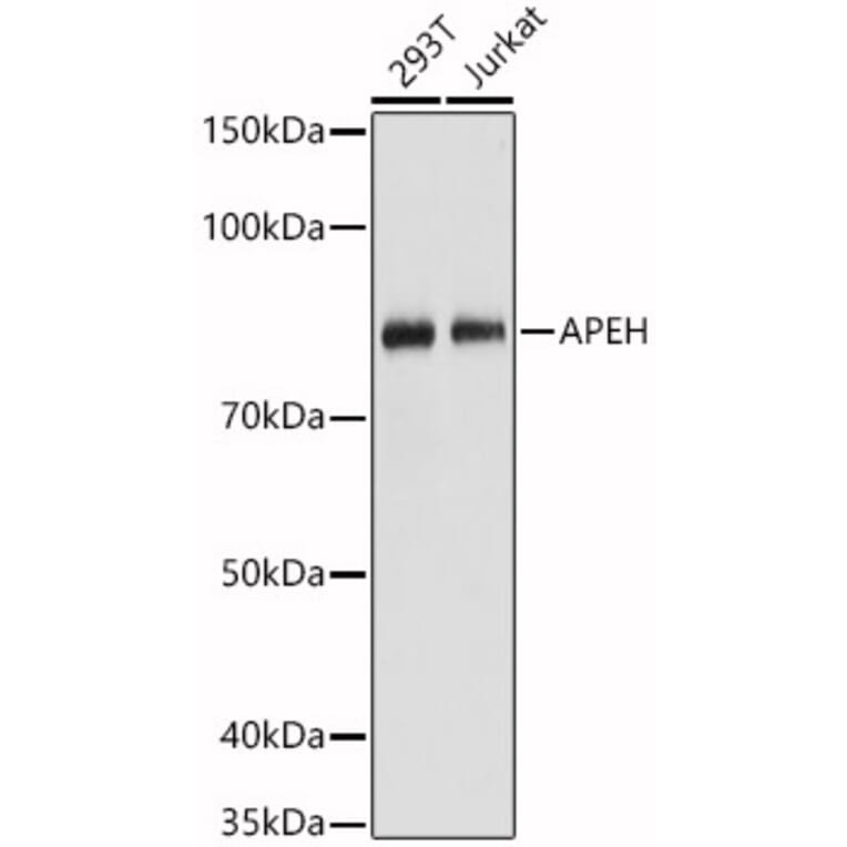 Western Blot - Anti-APH Antibody (A15042) - Antibodies.com