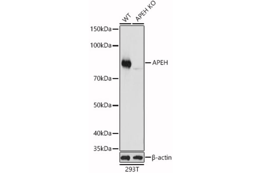 Western Blot - Anti-APH Antibody (A15042) - Antibodies.com