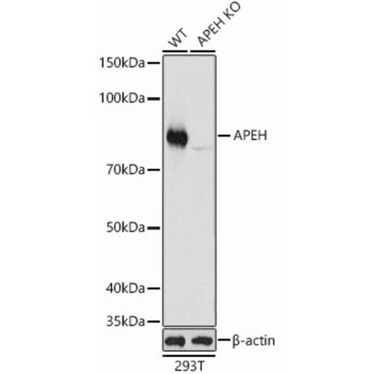 Western Blot - Anti-APH Antibody (A15042) - Antibodies.com