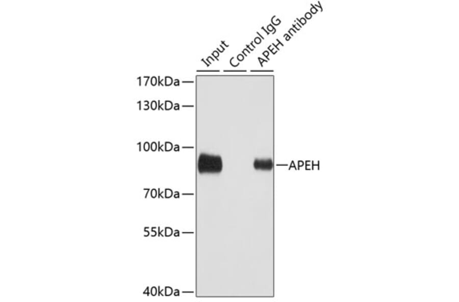 Western Blot - Anti-APH Antibody (A15042) - Antibodies.com