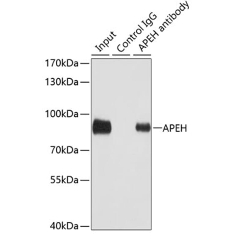 Western Blot - Anti-APH Antibody (A15042) - Antibodies.com